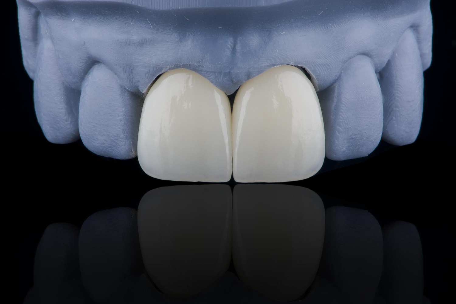 dental crowns