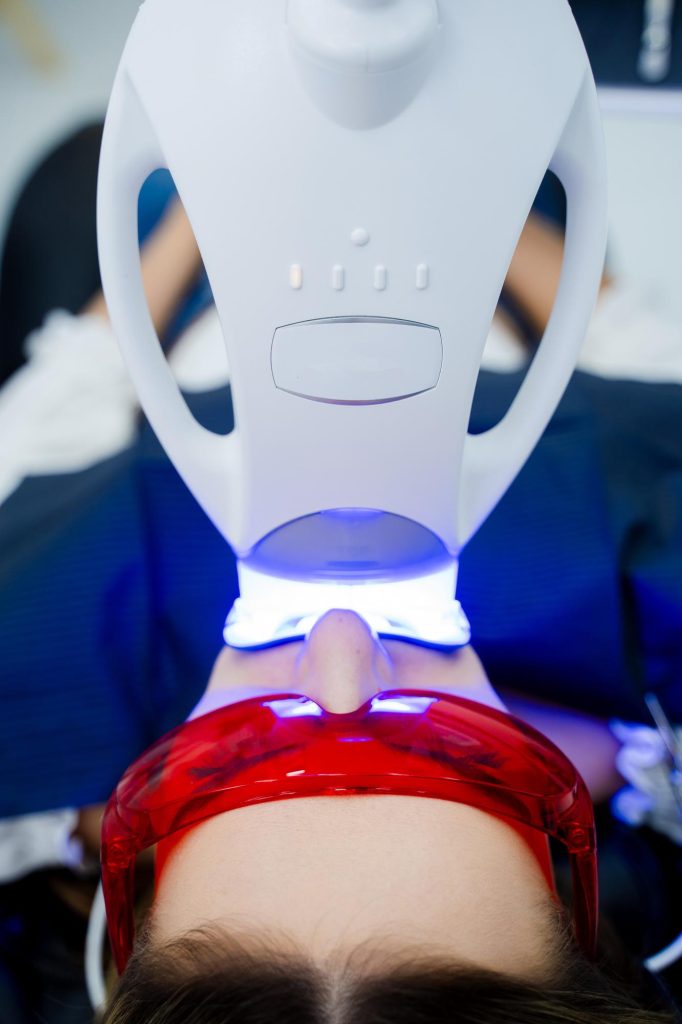 teeth whitening