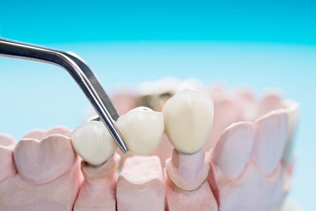 teeth